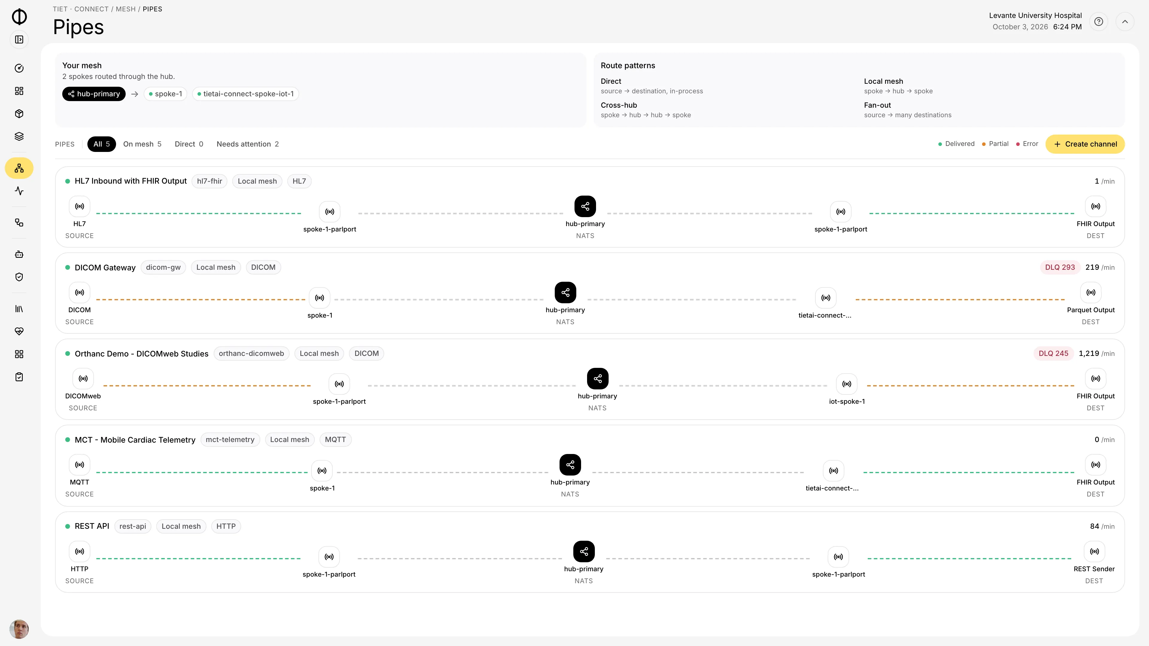 Tiet · Connect integration pipes